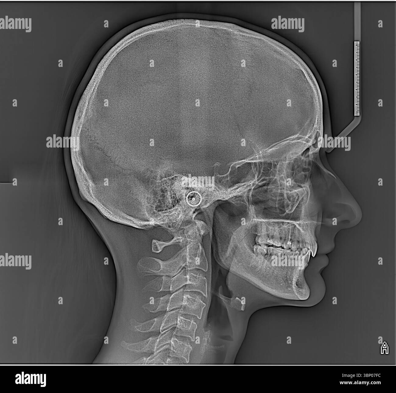 Radiografia anatomica di un cranio umano che mostra la struttura dettagliata del cranio, delle ossa facciali e delle vertebre superiori per informazioni didattiche e mediche Foto Stock