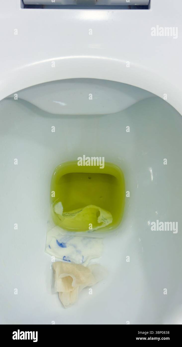Uno sguardo ravvicinato a una ciotola della carta igienica non lavata contenente materiali di scarto, evidenziando l'importanza dell'igiene e del corretto smaltimento dei rifiuti nei servizi igienici Foto Stock
