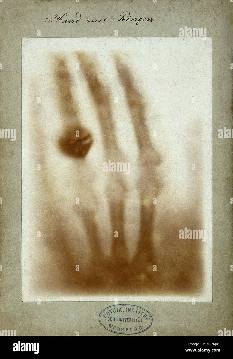 Hand mit Ringen (mano con anelli), 1895. Questa stampa storica mostra una delle prime radiografie scattate da Wilhelm Röntgen, che cattura la mano sinistra di sua moglie Anna Bertha Ludwig con il suo anello chiaramente visibile. L'immagine innovativa, presentata al professor Ludwig Zehnder dell'Istituto Physik dell'Università di Friburgo il 1° gennaio 1896, segna una pietra miliare nell'imaging medico. Foto Stock