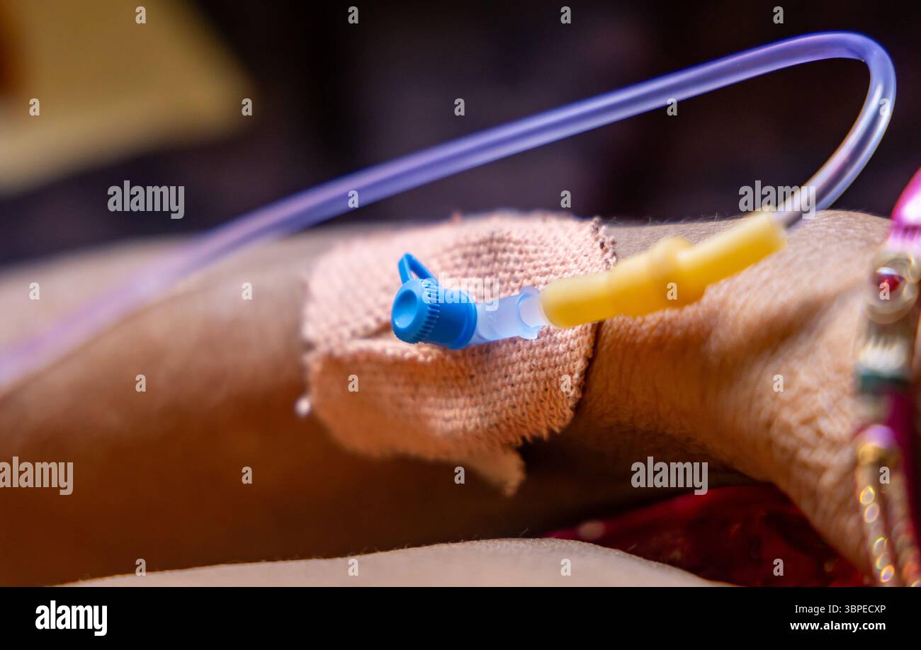 Mano del paziente con cannula IV in ambiente clinico in ambienti chiusi Foto Stock