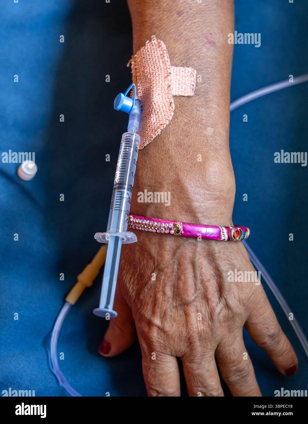 iniezione cannula completa inserita nella mano del paziente durante il giorno in ambienti chiusi Foto Stock