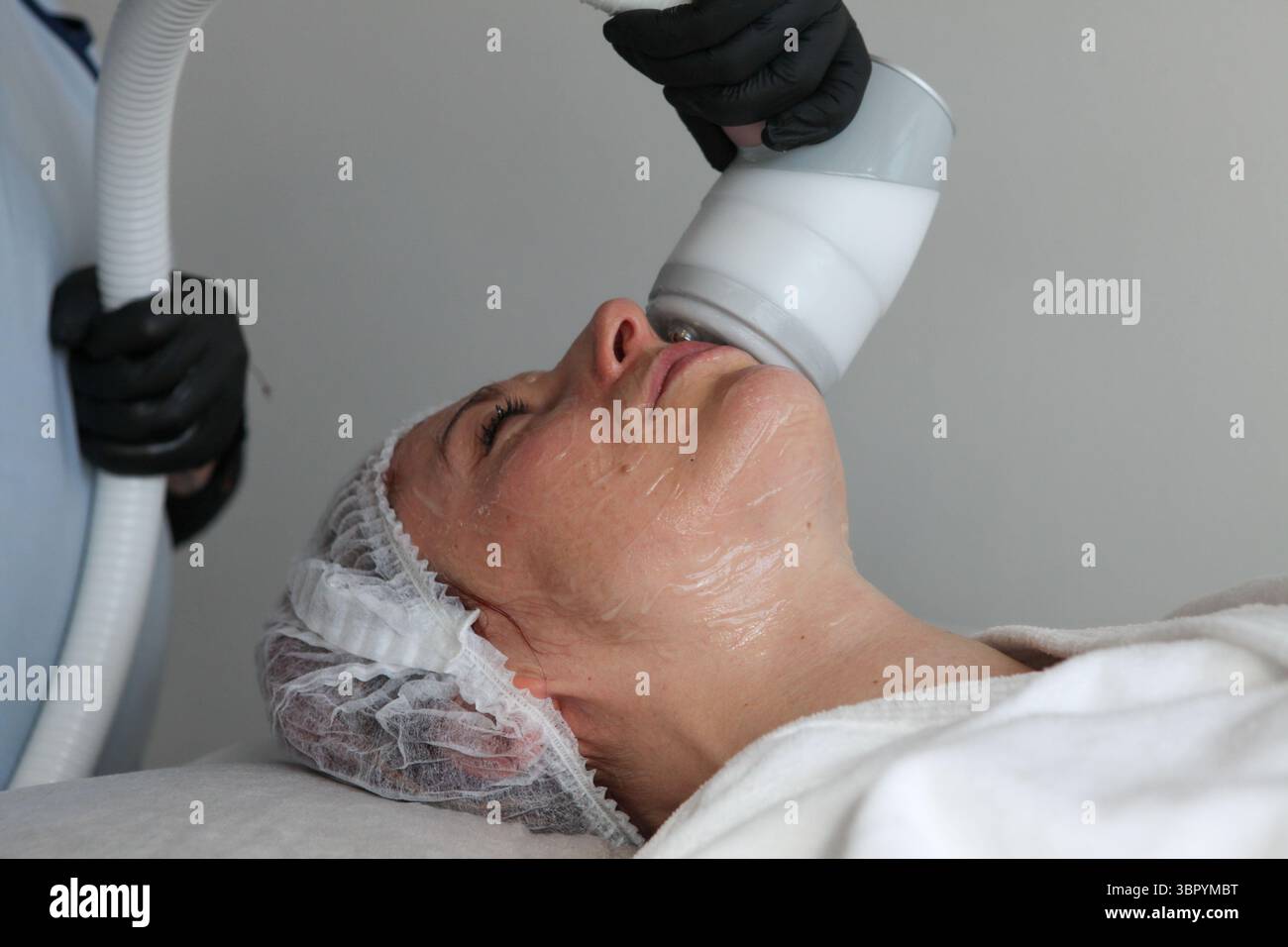 Giovane donna che riceve un trattamento viso Cryo-radio-frequenza presso una clinica di bellezza eseguita da uno specialista con attrezzature specializzate, concentrandosi sulla pelle Foto Stock
