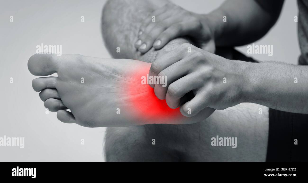 Uomo di graffiare il prurito sul suo piede con eruzione cutanea rossa Foto Stock