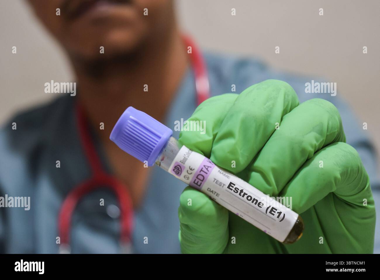 Testo Estrone E1 di è scritto su un campione di bottiglia con sfondo di un medico con una maschera di guanti medica. Concetto medico Foto Stock