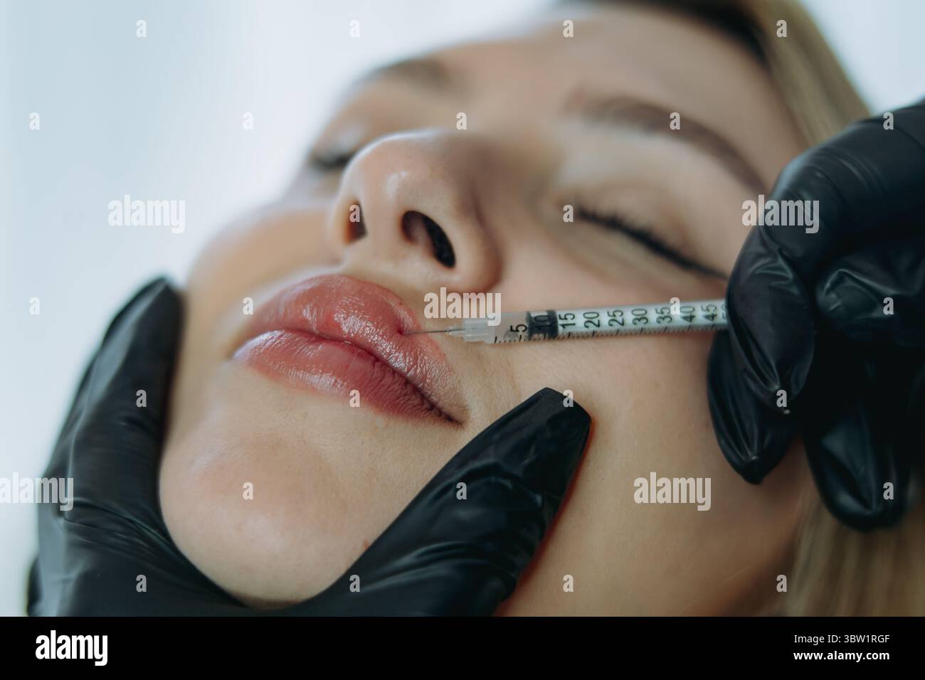 Precision Lip Enhancement: Trattamento iniettabile professionale in corso. Foto di alta qualità Foto Stock
