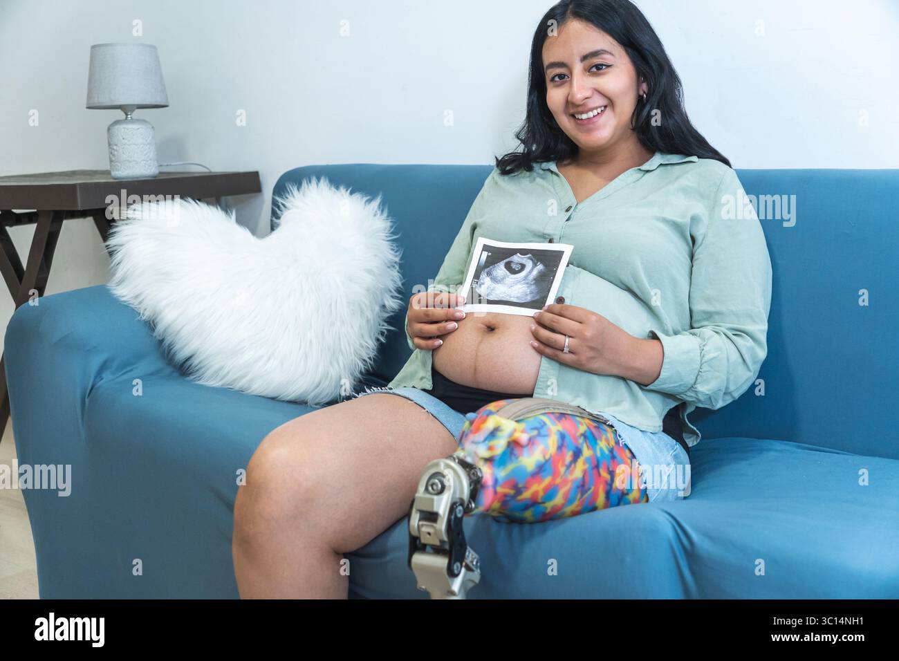 Donna incinta felice con una gamba protesica seduta su un divano, che tiene in mano una scansione ecografica del suo bambino Foto Stock