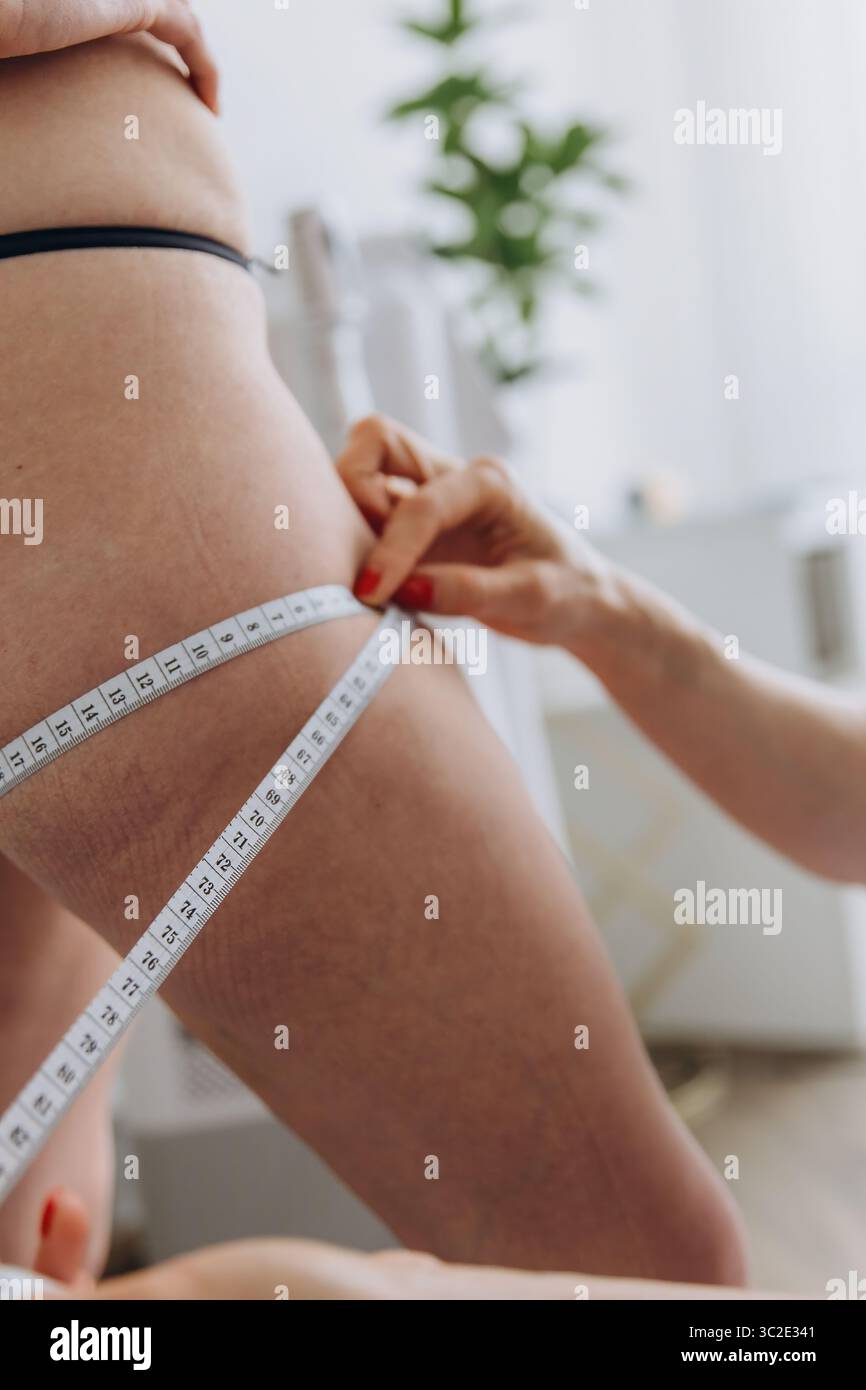 Cosmetologo che misura la coscia della donna prima del massaggio anti-cellulite. Concetto di misurazione del corpo, fitness, perdita di peso, cellulite, positività corporea, o pe Foto Stock