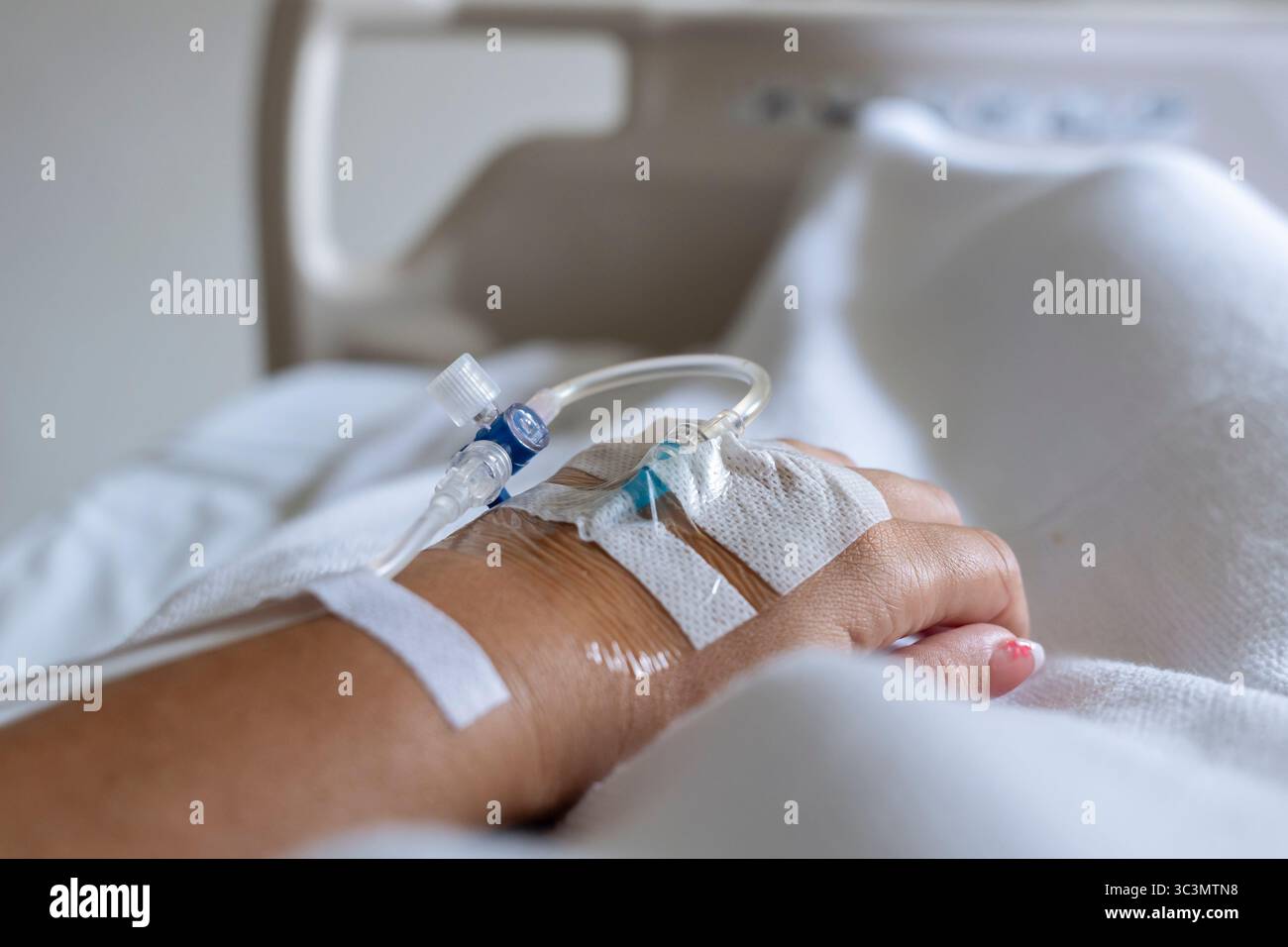 Una giovane donna malata sta riposando in un letto d'ospedale a Bali, ricevendo cure. È raffigurata con un gocciolamento IV attaccato alla mano, evidenziando un ser Foto Stock