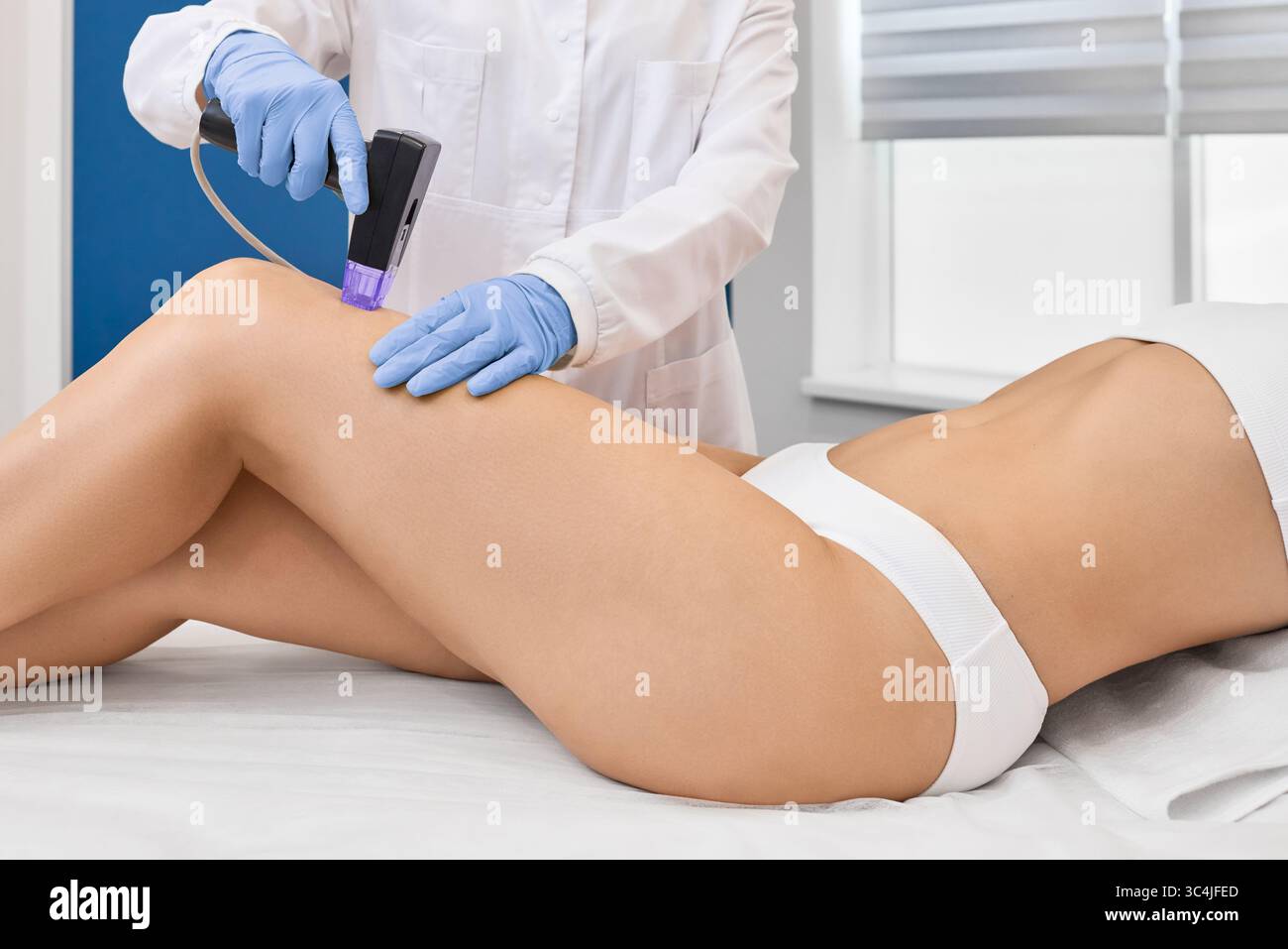 Microrivestimento RF-lifting per la pelle delle gambe di una paziente femminile in salone di cosmetologia per migliorare la pelle delle gambe e combattere le rughe. Sollevamento a radiofrequenza Foto Stock