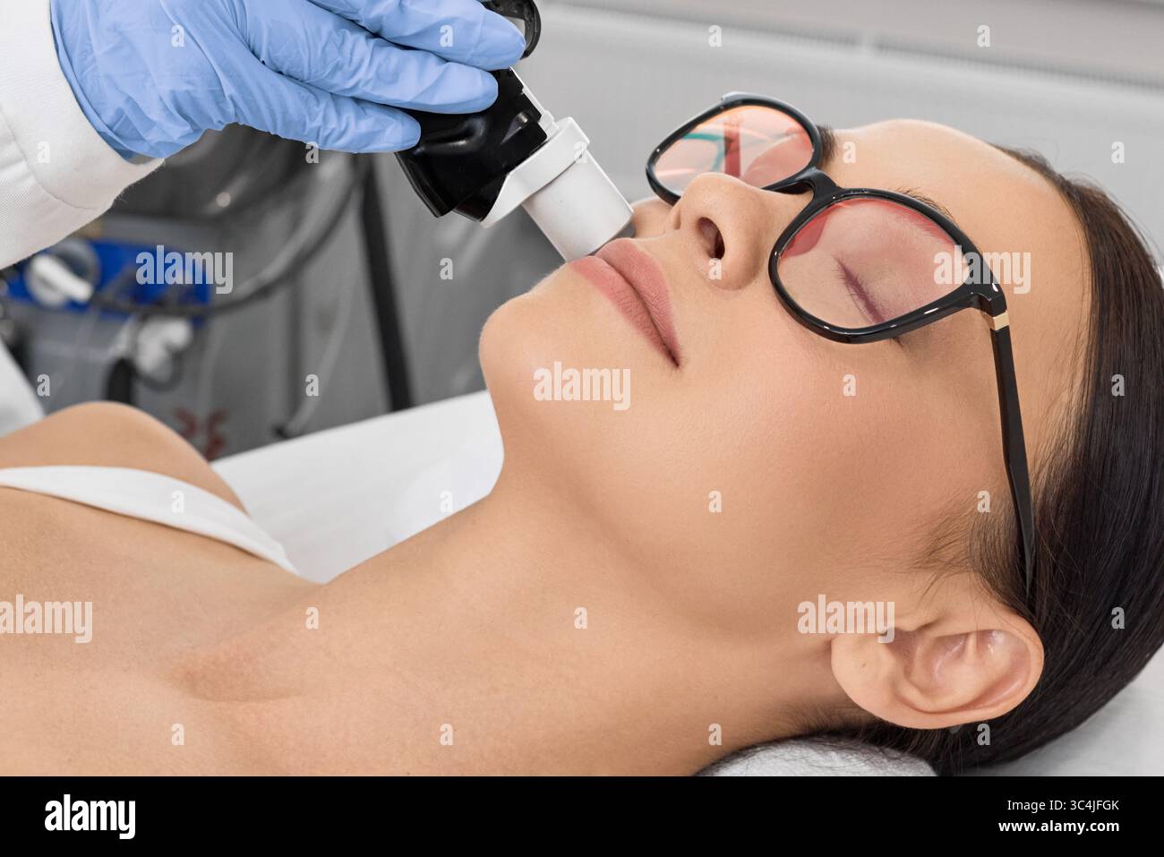 Rimozione dei peli del laser facciale. Bella donna durante la rimozione dei capelli laser e l'epilazione laser alla zona delle labbra sul viso Foto Stock