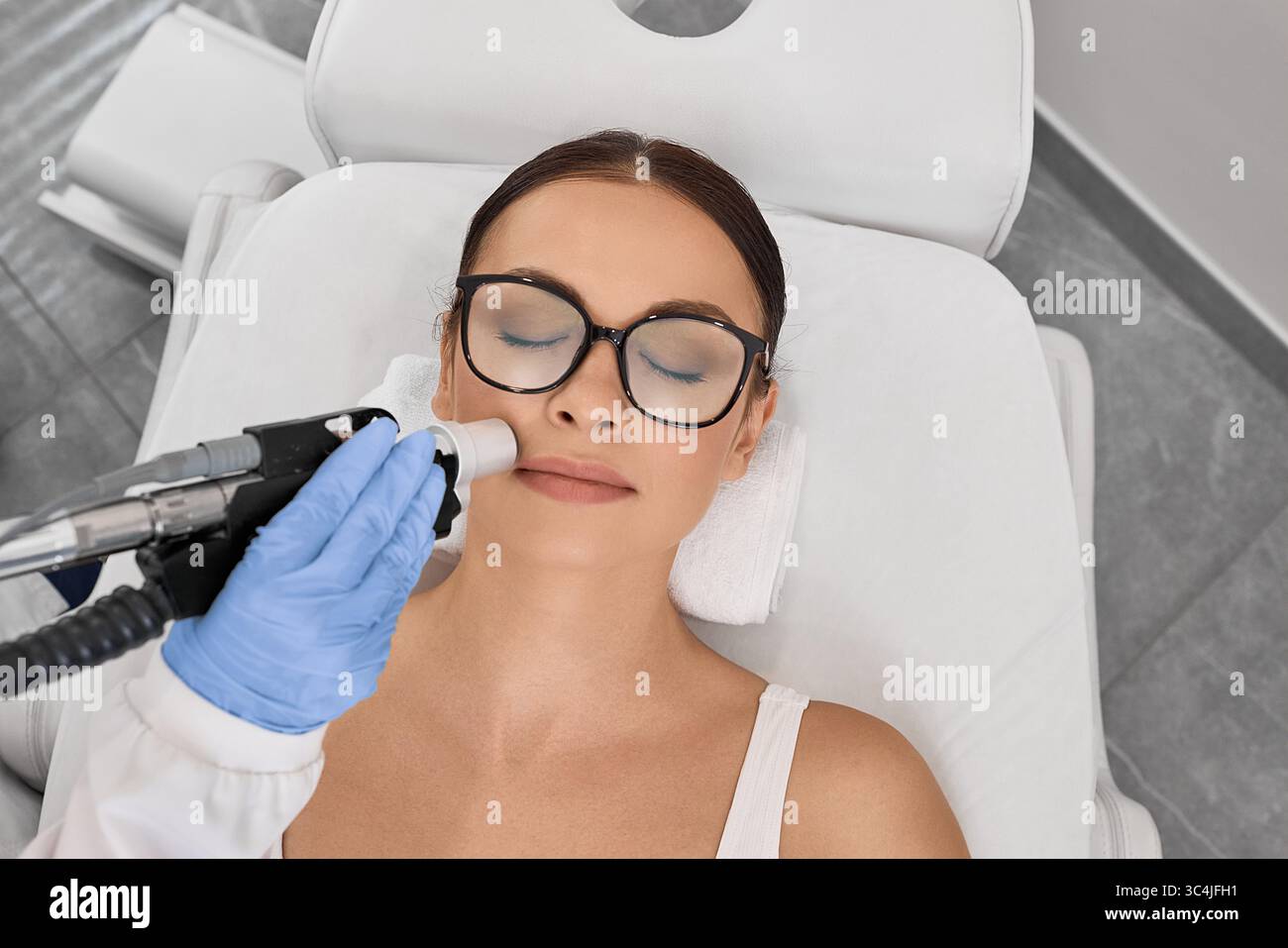 Rimozione dei peli sulle labbra. Donna durante una procedura di rimozione dei capelli del laser e la rimozione dei baffi femminili Foto Stock