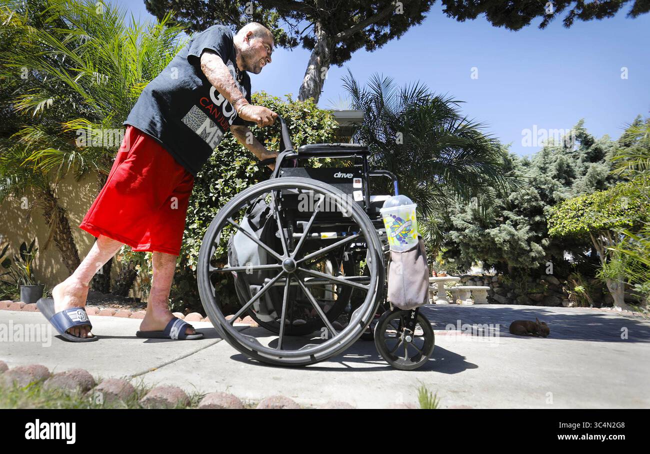 5 settembre 2018 - CA, USA - Julio Edeza spinge la sua sedia a rotelle per aiutarlo a mantenere l'equilibrio mentre continua a lavorare al recupero in una casa di gruppo il 5 settembre 2018 a Spring Valley, California. Edeza ha bruciato il 90% del suo corpo il 17 aprile 2016, quando per nessun motivo un uomo lo ha avvicinato fuori dal Rite Aid vicino a Federal Boulevard e Euclid Avenue a Oak Park, lo ha riempito di carburante da corsa ad alte prestazioni e gli ha dato fuoco. Julio dice di aver perdonato l'aggressore che è stato condannato a quattro ergastoli all'inizio di quest'anno. (Immagine di credito: © Howard Lipin/The San Diego Union-Tribune/TNS via Z Foto Stock