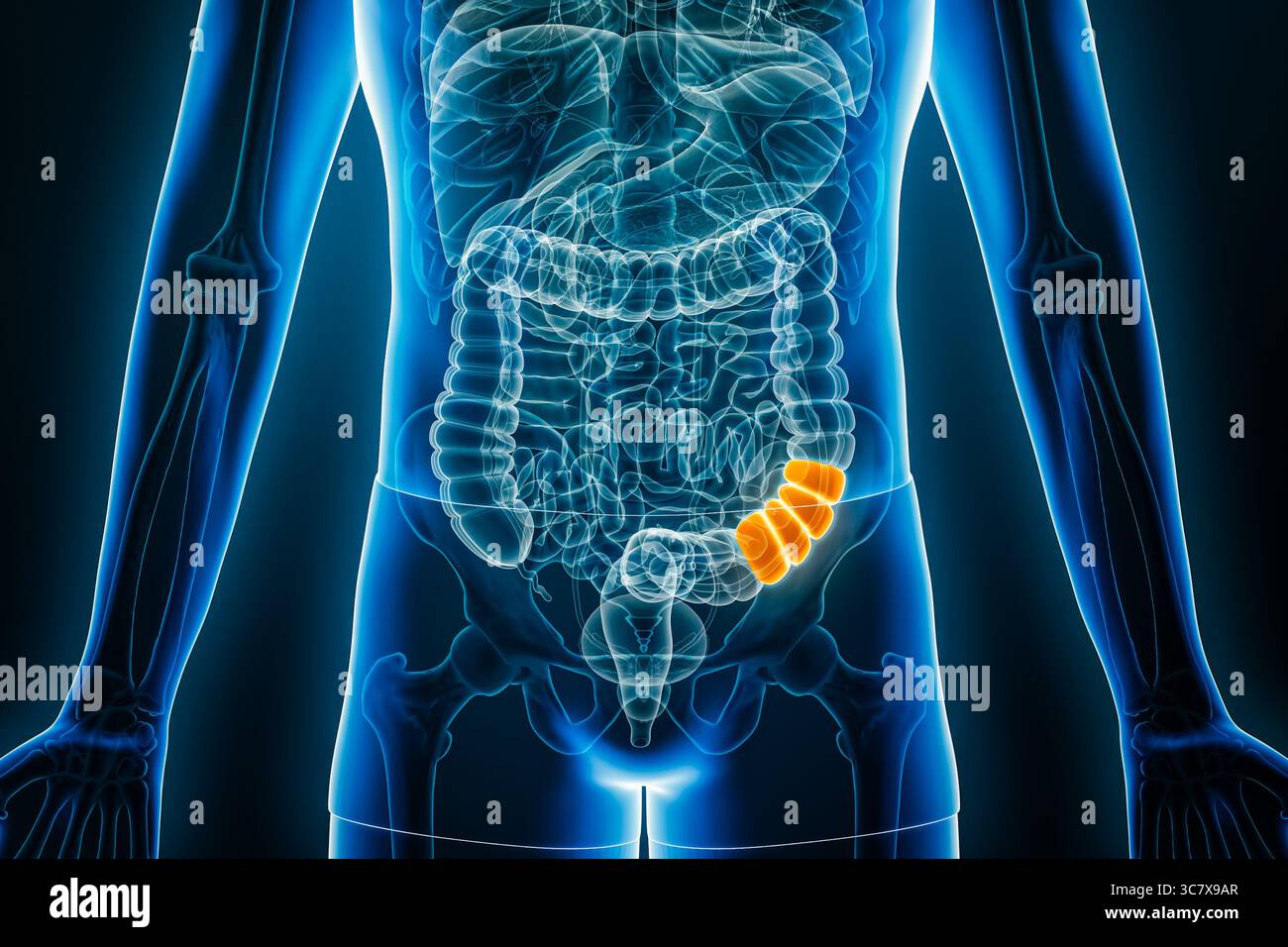 Vista radiologica anteriore della giunzione discendente-sigmoidea o flessione sigmoidea del colon illustrazione di rendering 3D con contorni corporei. Anatomia, organo di scavo Foto Stock Vista radiologica anteriore della giunzione discendente-sigmoidea o flessione sigmoidea del colon illustrazione di rendering 3D con contorni corporei. Anatomia, organo di scavo Foto Stock