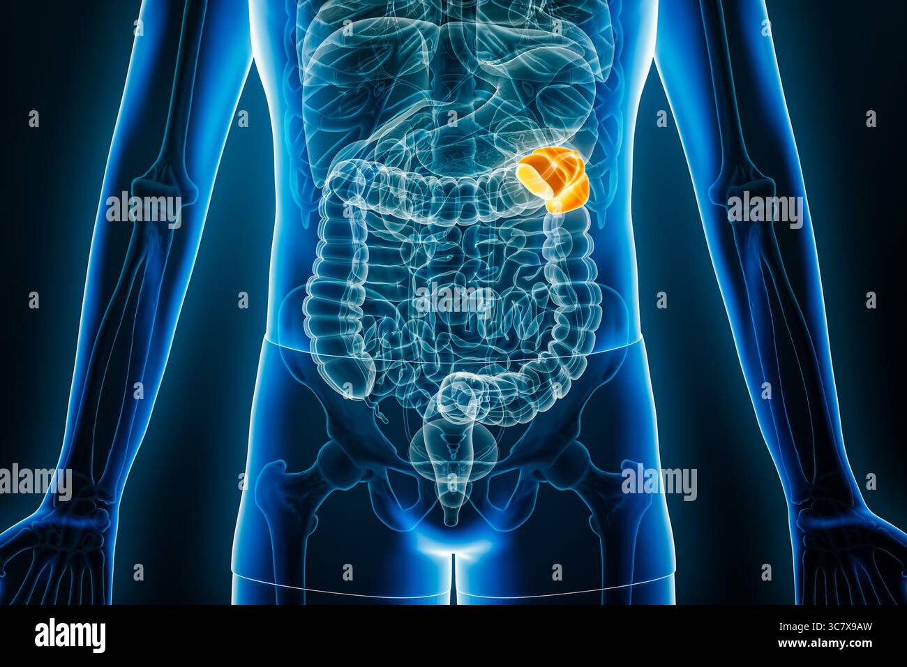Vista radiologica anteriore della flessione splenica o sinistra del colon umano illustrazione di rendering 3D con contorni del corpo maschile. Anatomia, organo del sistema digerente Foto Stock