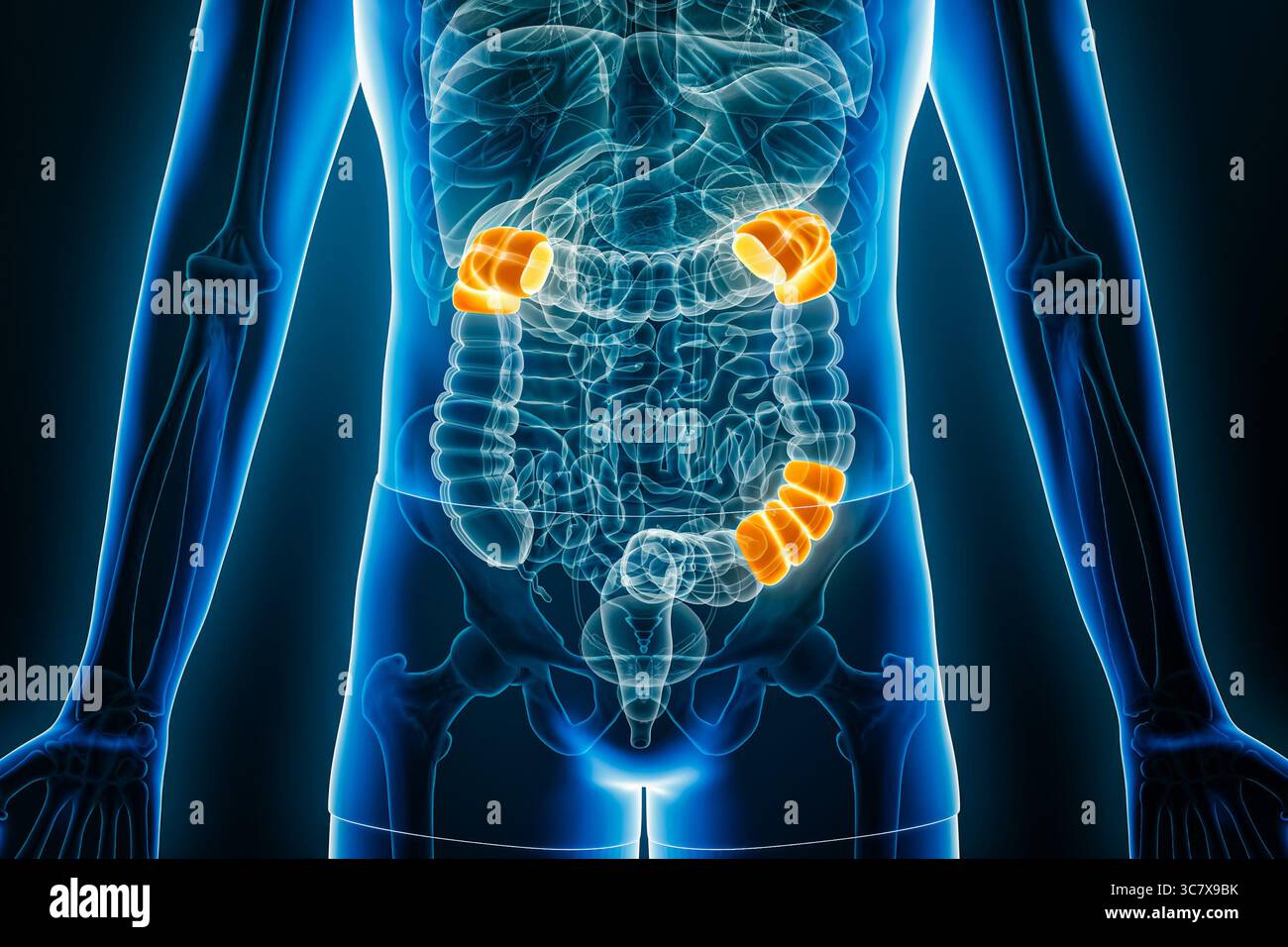 Vista radiologica anteriore o frontale delle flessioni del colon umano illustrazione di rendering 3D con contorni del corpo maschile. Anatomia, organo dell'apparato digerente, farmaco Foto Stock