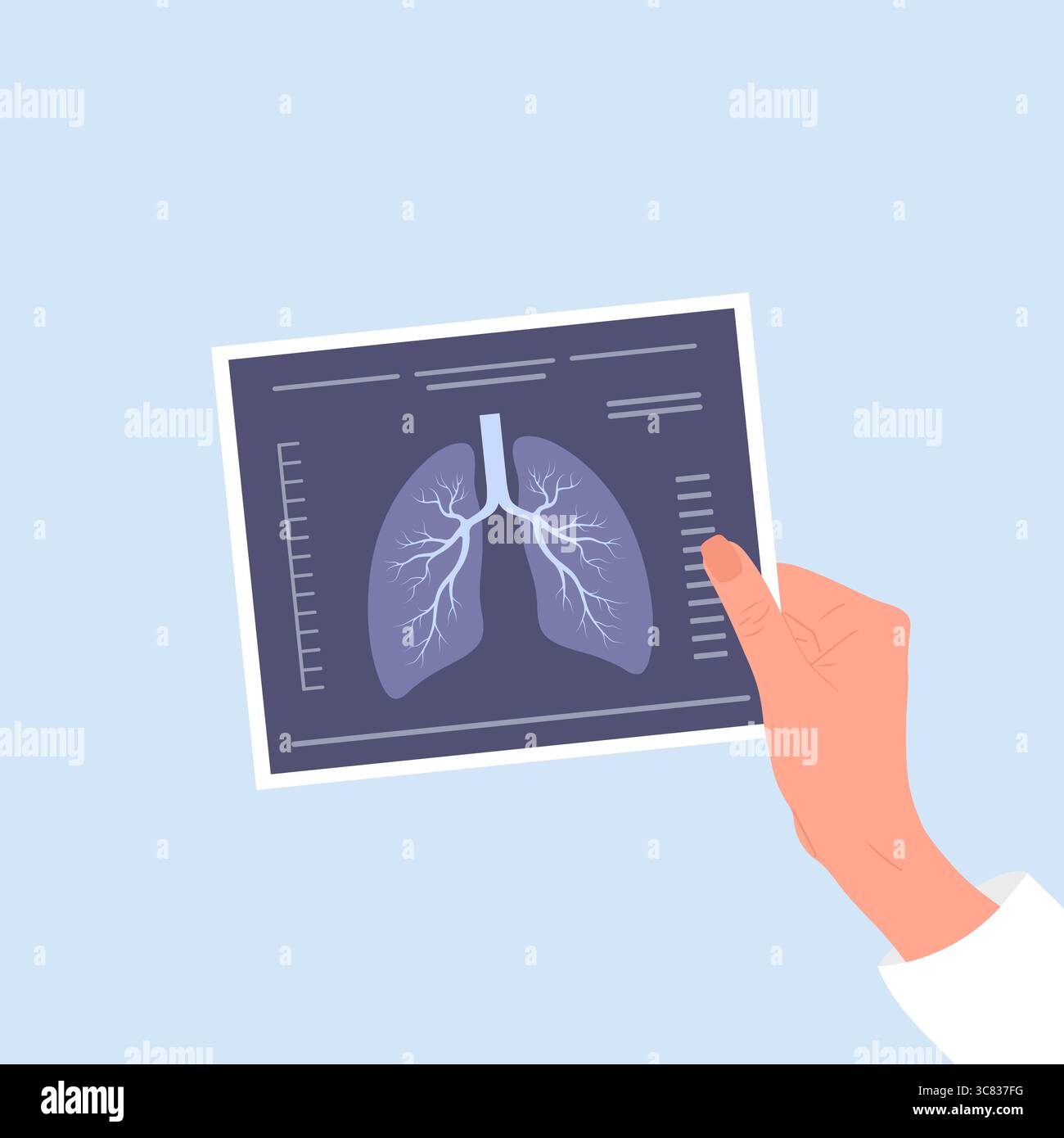 Concetto di fluorografia. Mano del medico che tiene la scansione a raggi X. Salute polmoni controllare. Illustrazione vettoriale in stile cartone animato piatto Illustrazione Vettoriale