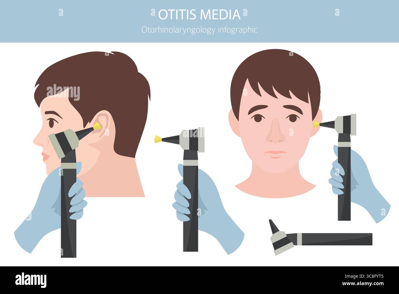 Otite media. Infezione nell'orecchio medio. Infografica sui disturbi otologici. Illustrazione vettoriale Illustrazione Vettoriale