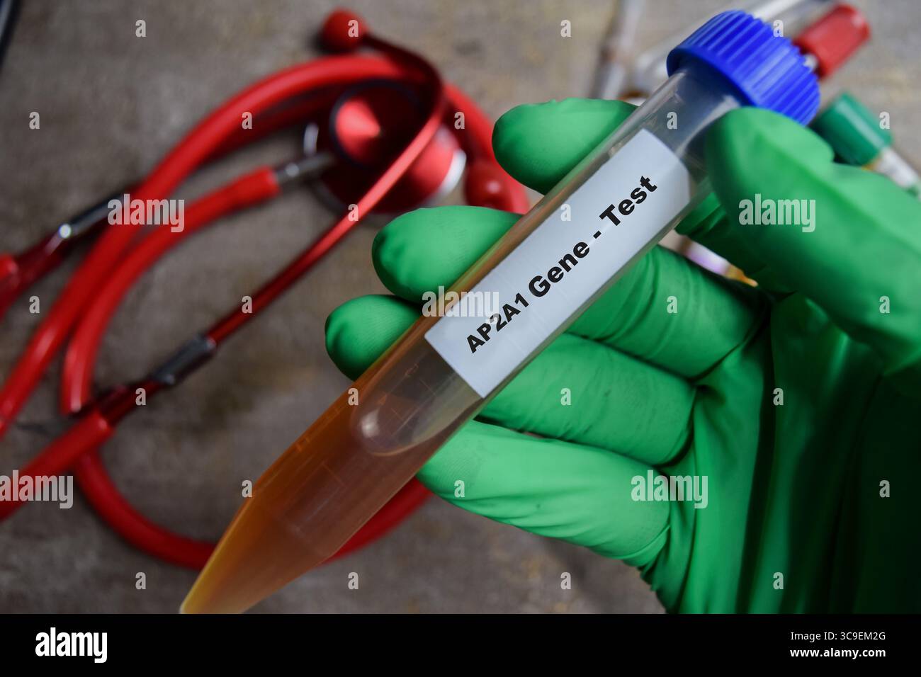 AP2A1 Gene - test con campione di sangue nelle mani con guanti verdi. concetto farmaceutico e sanitario Foto Stock