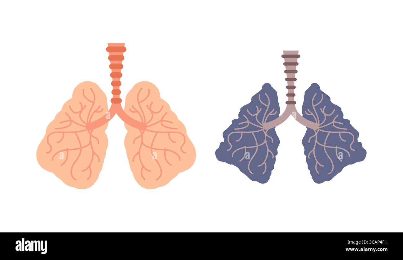 confronto polmoni sani e malati. Metafora visiva per fumo, inquinamento o malattie respiratorie. Perfetto per campagne sanitarie, educazione medica, Illustrazione Vettoriale