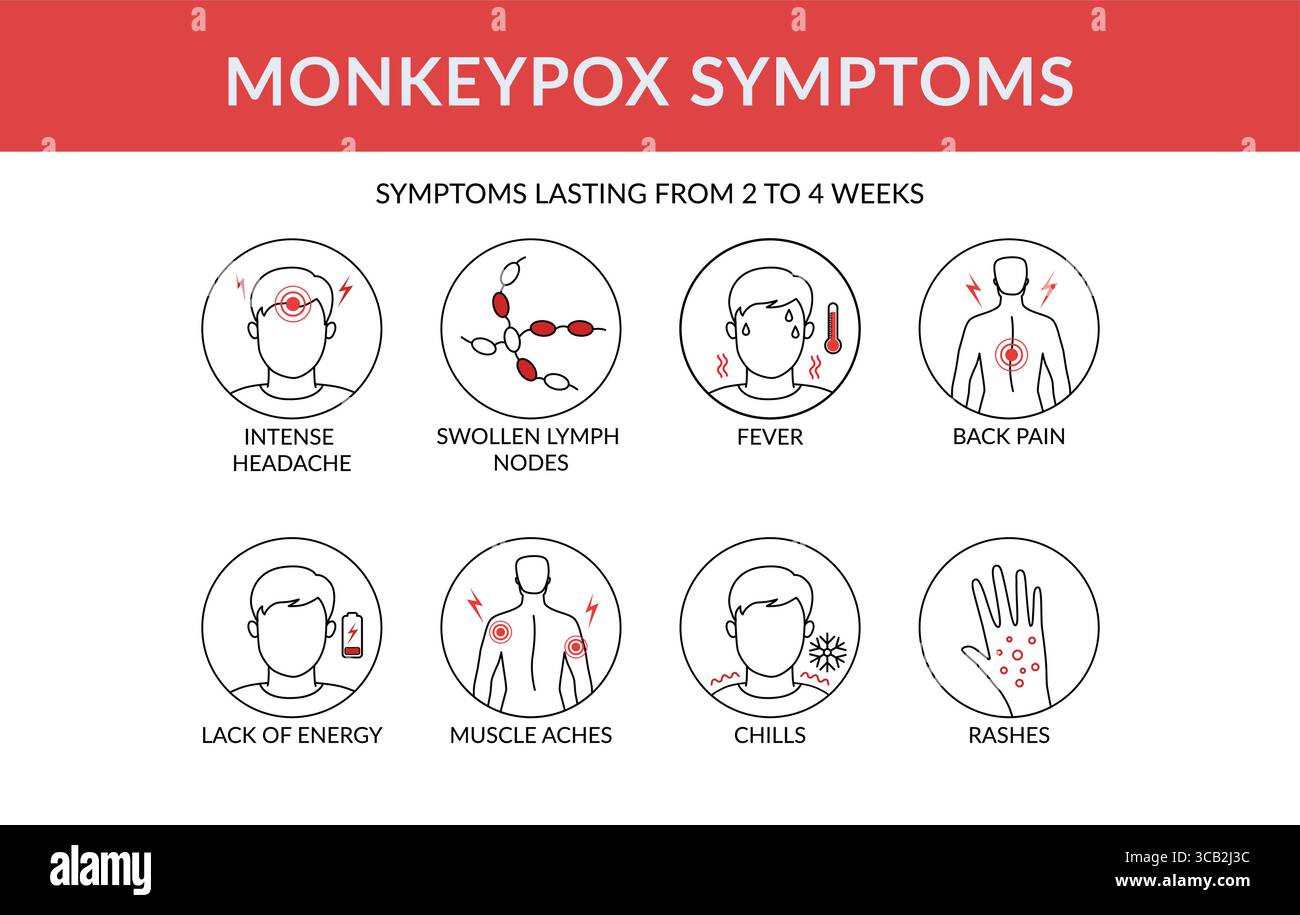 I sintomi dell'infografica del virus del vaiolo delle scimmie. Ciò provoca infezioni cutanee. Illustrazione vettoriale lineare Illustrazione Vettoriale