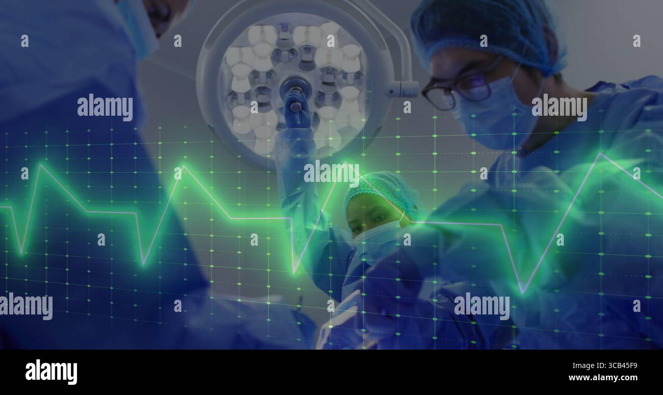 Squadra chirurgica in piedi che esegue l'intervento chirurgico in sala operatoria, con camici mascherine lampada e forma d'onda ECG Foto Stock