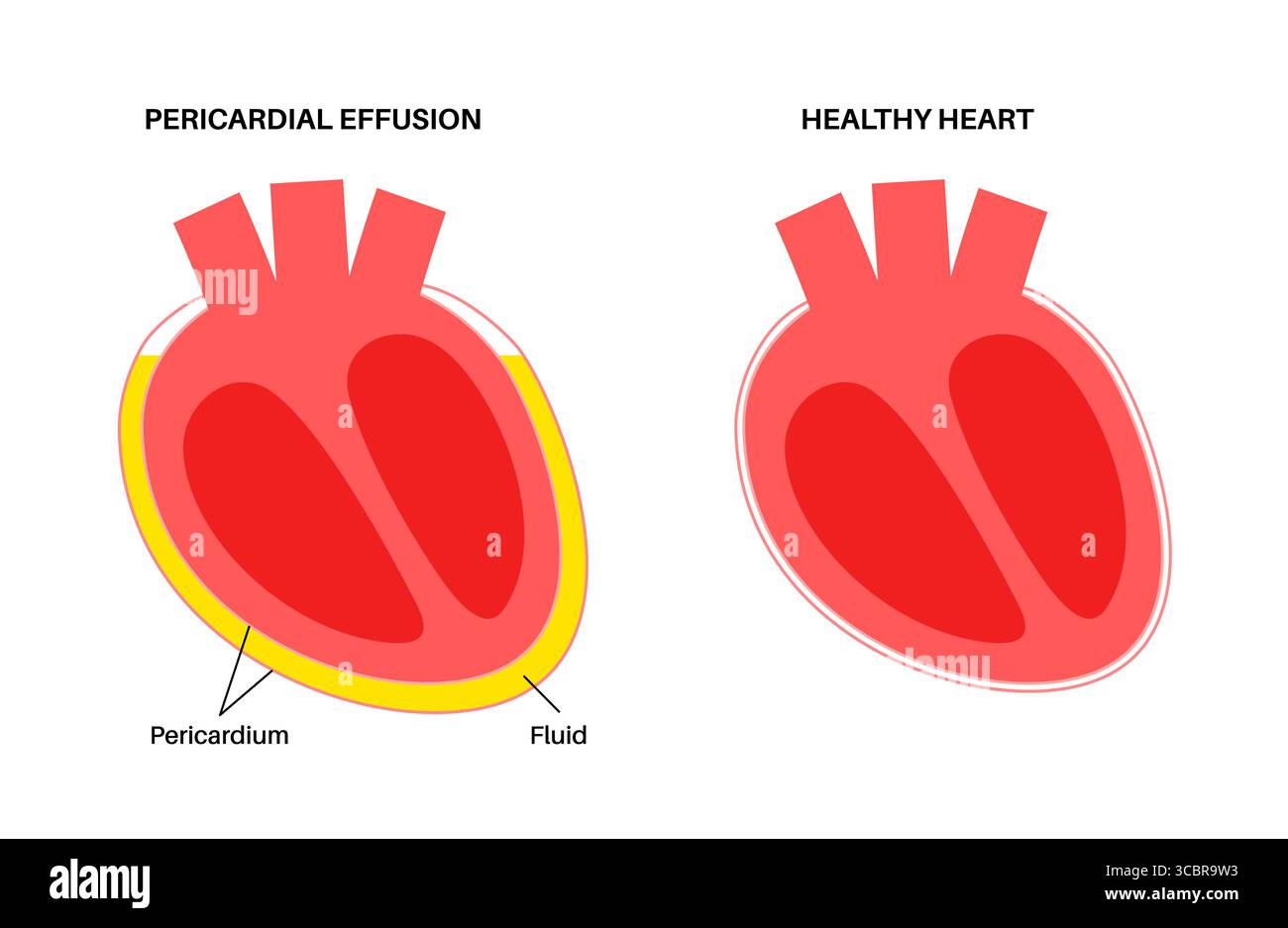 geekvape aegis solo 3 istruzioni Insufficienza cardiaca: sintomi, cause e cura