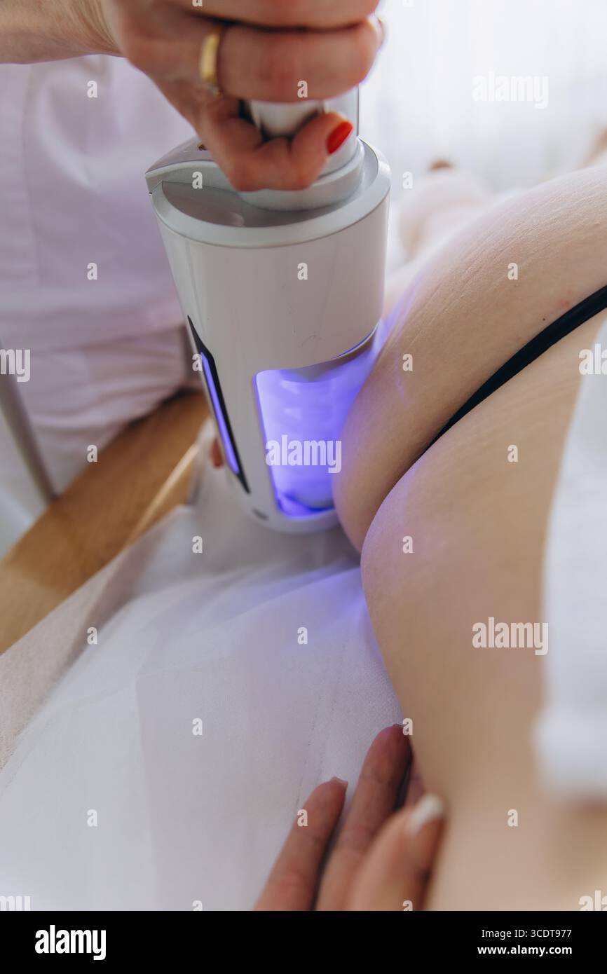Trattamento di massaggio Endosphere anti cellulite su fianchi donna. Contorno del corpo, drenaggio linfatico, modellamento delle figure e terapia di rafforzamento della pelle in bellezza Foto Stock