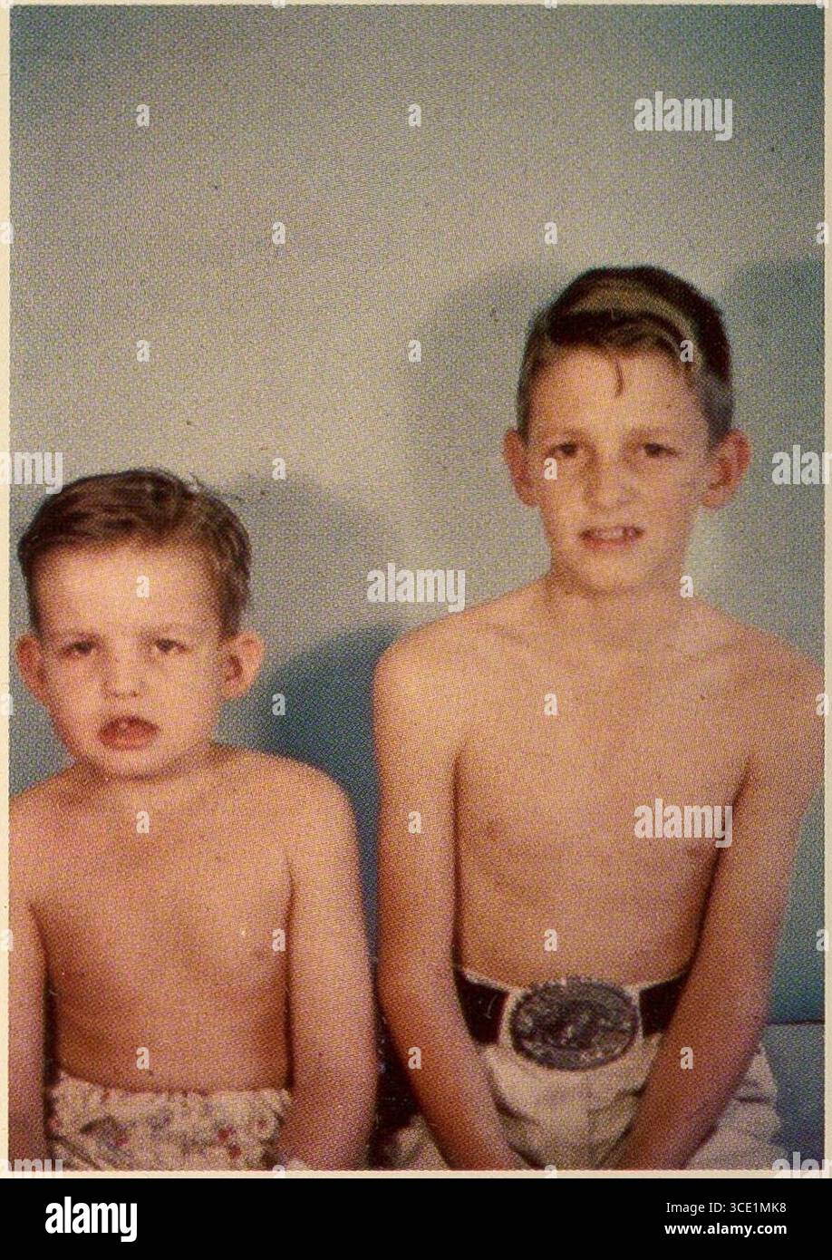 Sindrome del carcinoma basocellulare Nevoid 1. Foto Stock