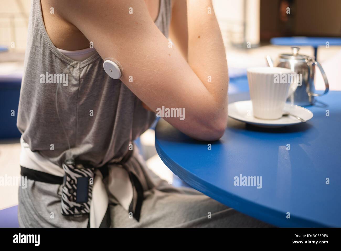 Primo piano di una donna con diabete di tipo 1 che indossa un monitoraggio continuo del sangue glucosio seduto in un bar con una bevanda calda Foto Stock