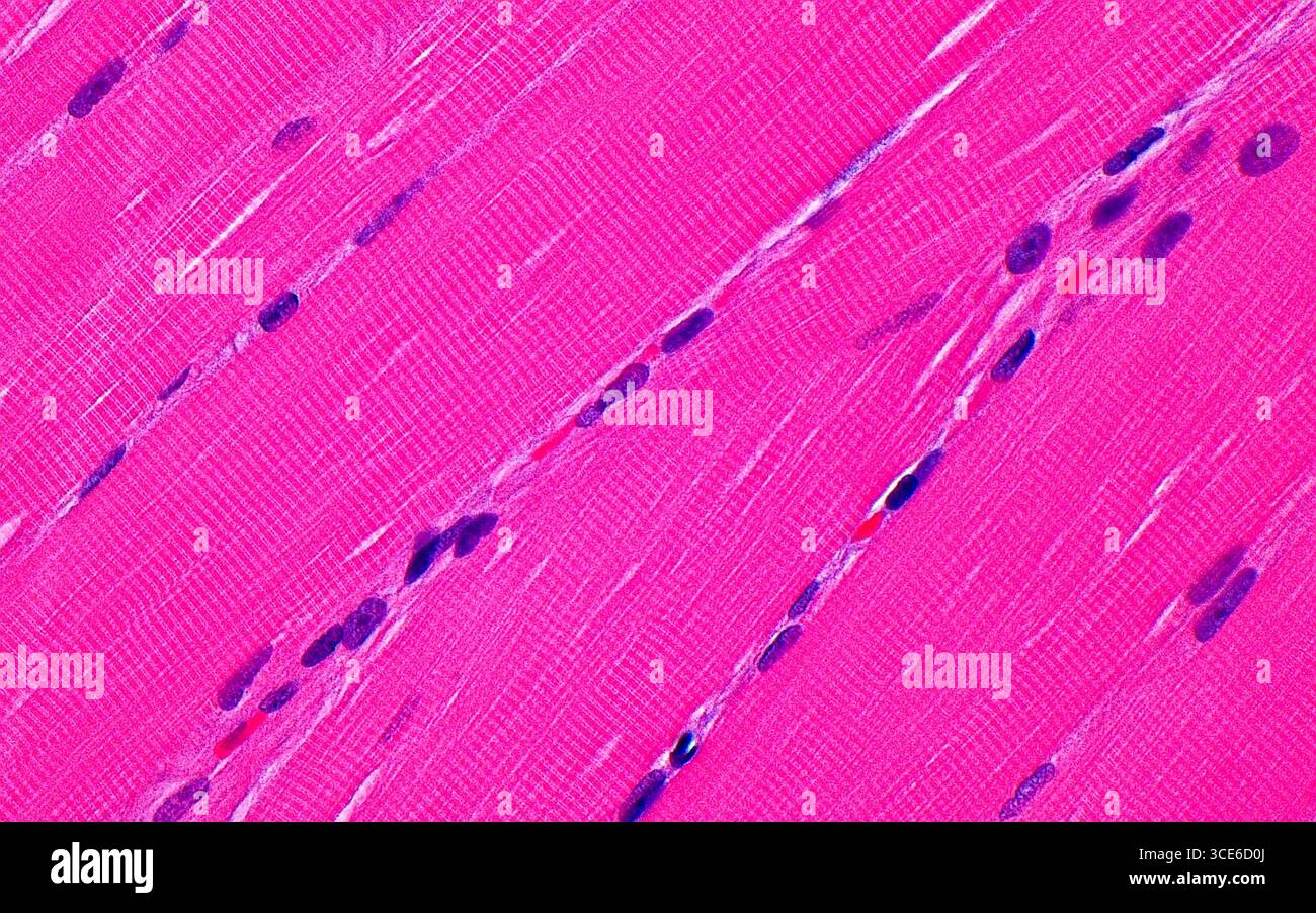 Micrografia leggera del muscolo scheletrico. Il muscolo scheletrico è composto da fibre (strutture rosa diagonali) attraversate da striature (linee chiare perpendicolari alle fibre rosa). I nuclei delle cellule muscolari (punti oblunghi blu scuro) sono disposti alla periferia delle fibre. Sezione di tessuto colorato con ematossilina ed eosina. Ingrandimento: 400x se stampato a 10 cm. Foto Stock