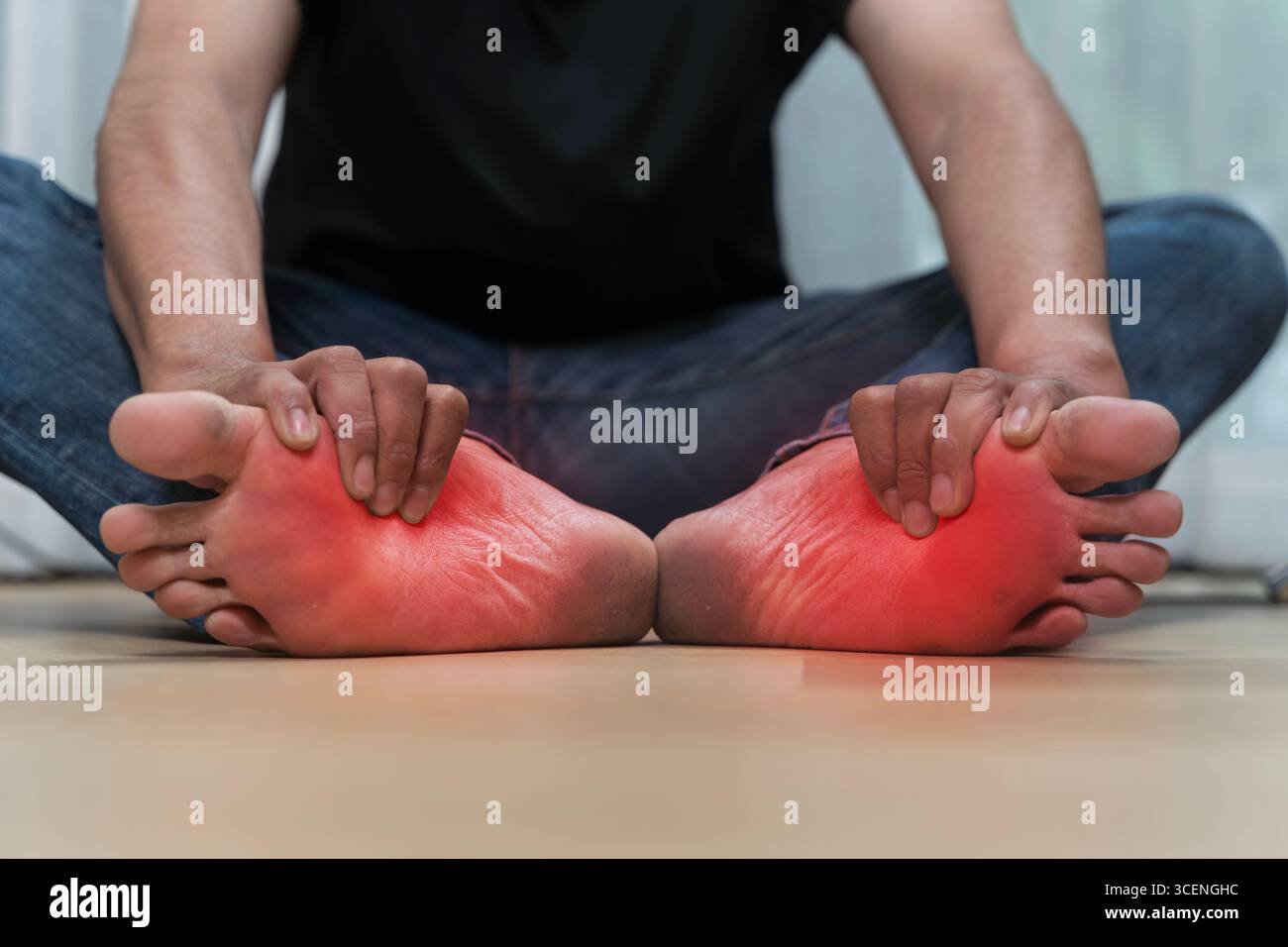 Primo piano di uomo seduto sul pavimento tenendo entrambi i piedi con rossore visibile e dolore, sintomi di infiammazione, fasciite plantare, neuropatia, gotta, o di Foto Stock