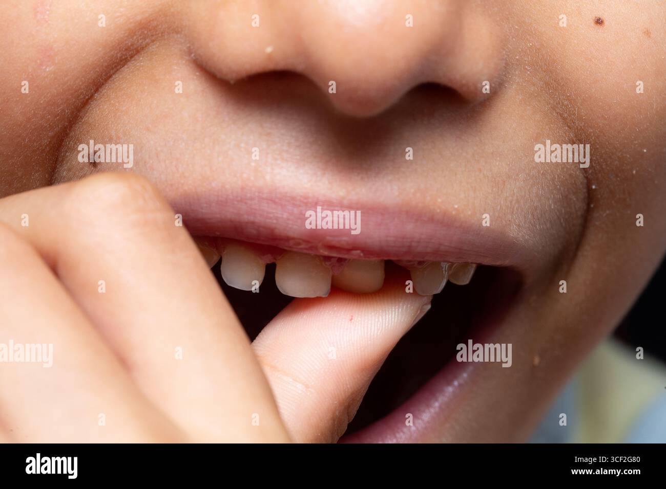 Primo piano di un bambino che tocca un dente libero con il dito, mostrando gengive, bocca e naso Foto Stock