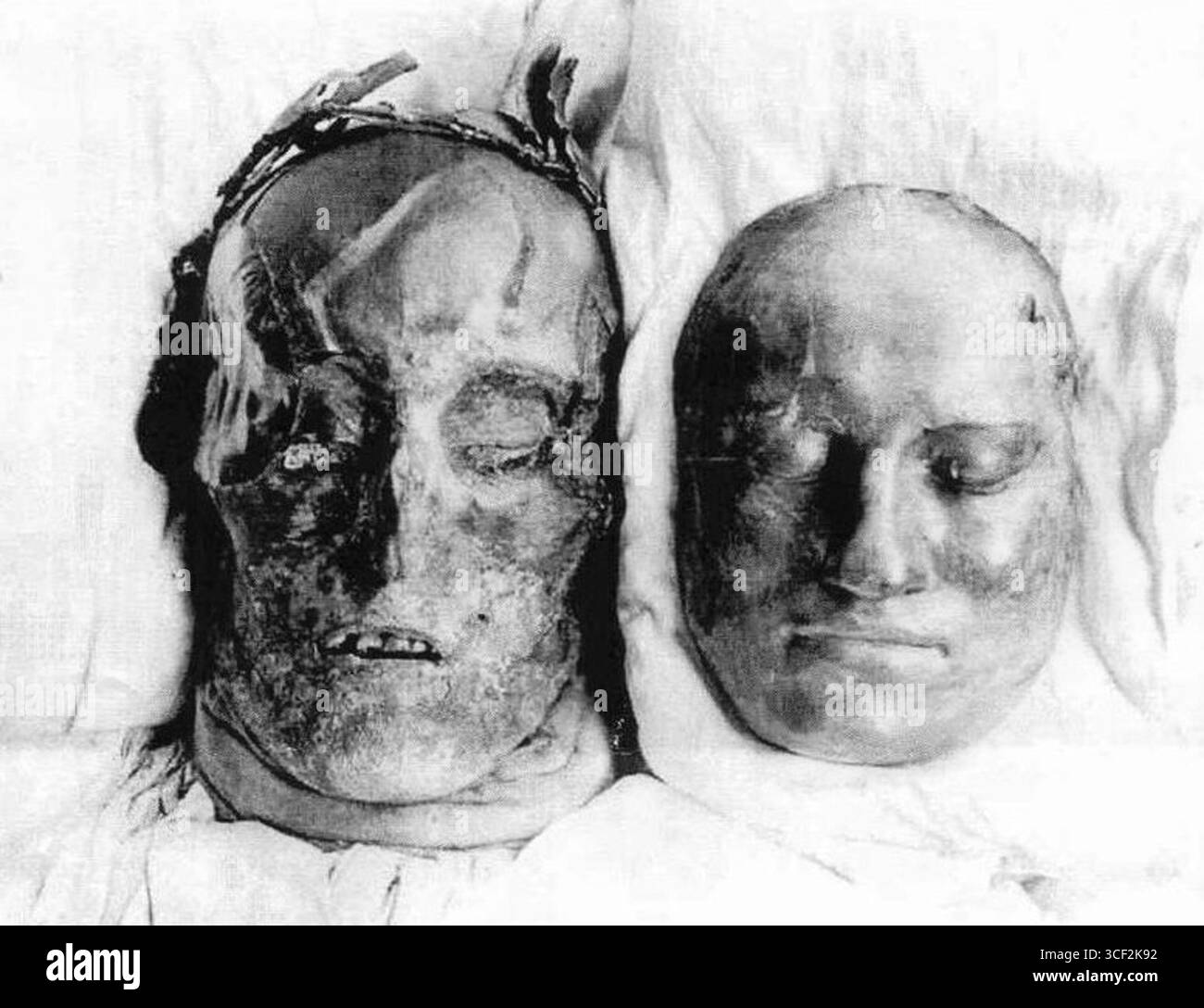 Fotografia scattata nel luglio 1917 da otto Mattsson, che mostra la mummia di Carlo XII di Svezia con la sua maschera mortuaria del 1718 posta accanto a lui. L'immagine illustra la decomposizione del corpo del re dopo quasi 200 anni. Foto Stock