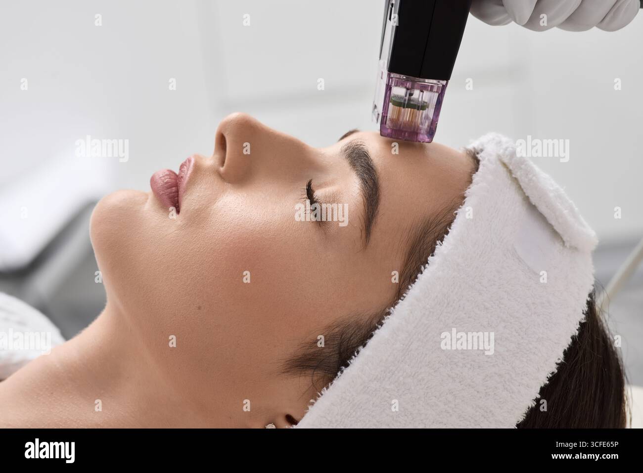 Sollevamento non chirurgico del viso della donna con l'aiuto di una nuova procedura di sollevamento a radiofrequenza microneedle. Procedura di sollevamento RF presso il salone di bellezza Foto Stock