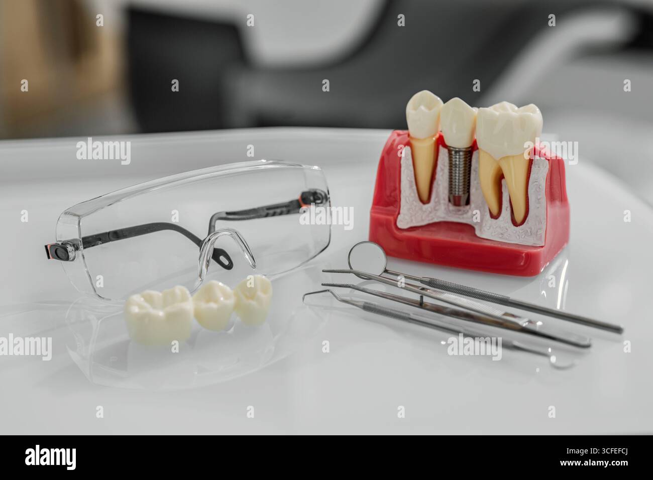 Strumenti e modelli dentali sono presentati su una superficie pulita, evidenziando la salute orale e le scelte di trattamento. Foto Stock