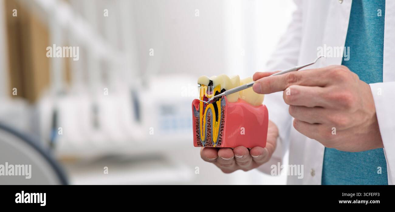 Il dentista mostra un modello di dente per evidenziarne l'anatomia e l'importanza della cura dentale durante una consultazione. Trattamento alla carie Foto Stock