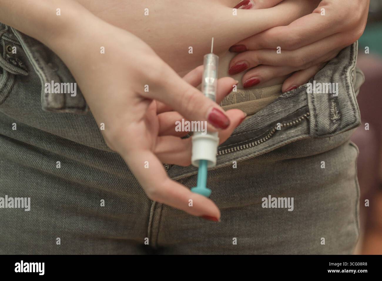 DATA RECORD NON DICHIARATA frau spritzt sich blutverdünner in deie bauchfalte frau spritzt sich blutverdünner in deie bauchfalte *** Woman inietta fluidificante del sangue nella piega dello stomaco la donna inietta fluidificante del sangue nella piega dello stomaco Foto Stock