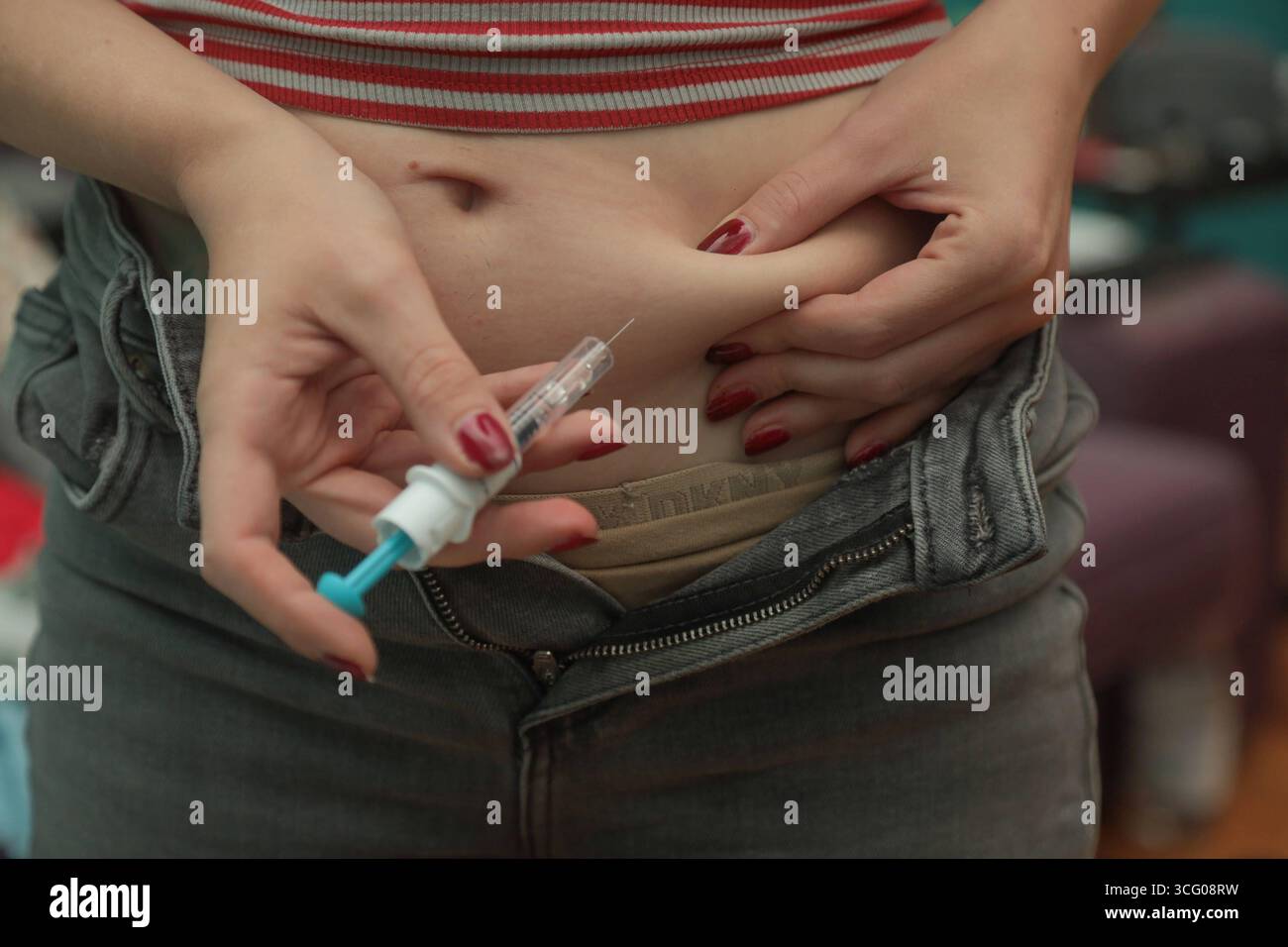DATA RECORD NON DICHIARATA frau spritzt sich blutverdünner in deie bauchfalte frau spritzt sich blutverdünner in deie bauchfalte *** Woman inietta fluidificante del sangue nella piega dello stomaco la donna inietta fluidificante del sangue nella piega dello stomaco Foto Stock