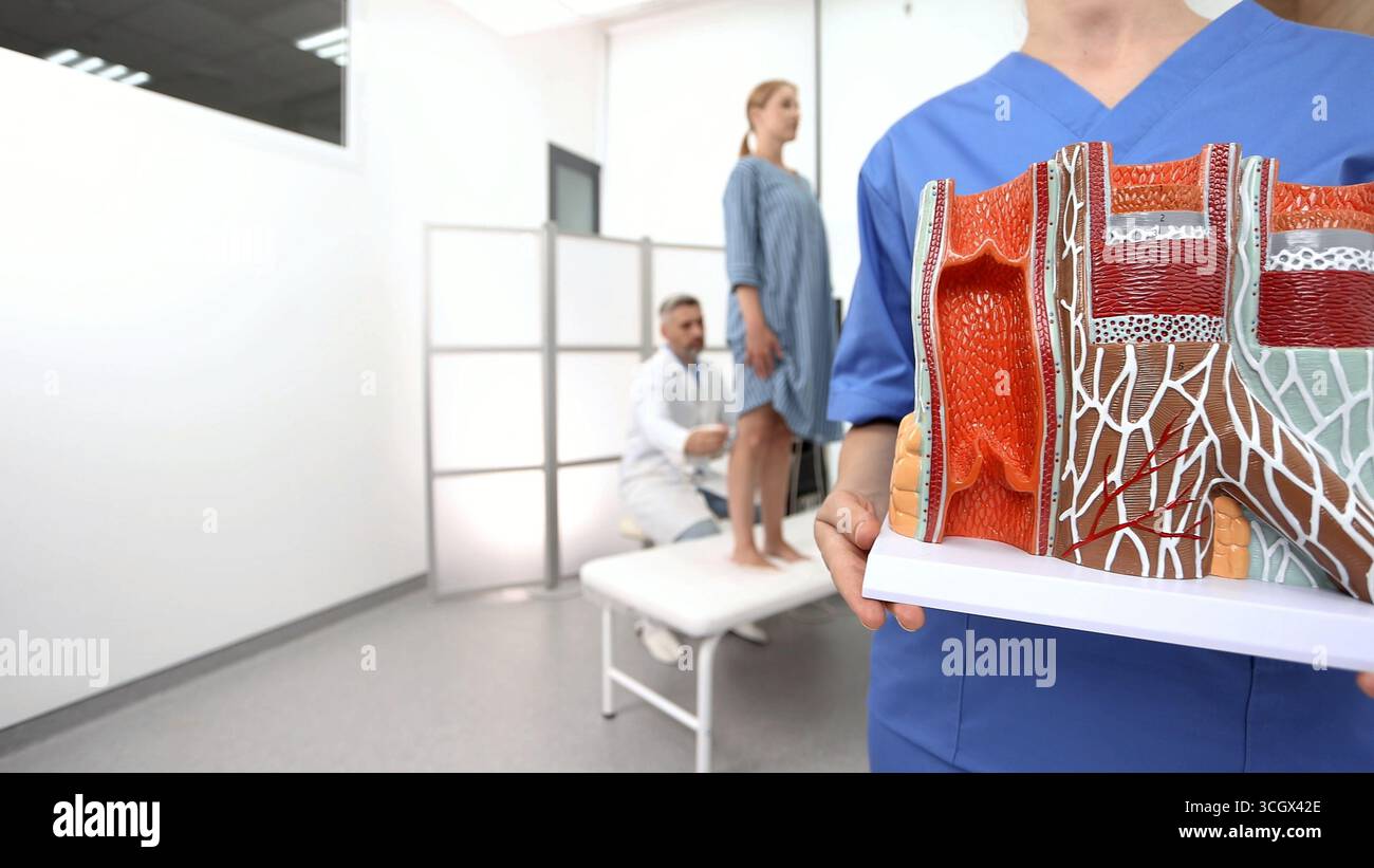 Diagnostica vascolare ecografica delle gambe della paziente con vene varicose, primo piano del modello anatomico. Ecografia venosa delle gambe Foto Stock