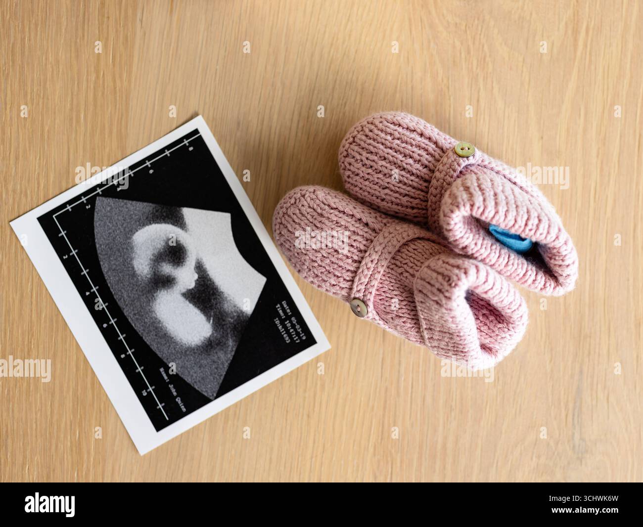 Stivaletti rosa accanto all'immagine a ultrasuoni sul tavolo di legno, per celebrare il nuovo arrivo a casa Foto Stock