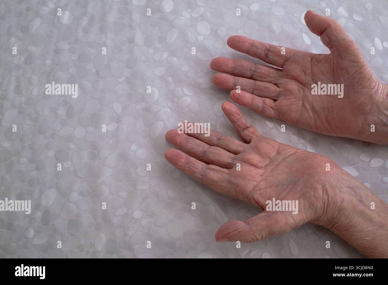 Primo piano di mani stropicciate di un adulto anziano che riposa su una superficie bianca a motivi geometrici, evidenziando gli effetti di una malattia neurologica. Foto Stock