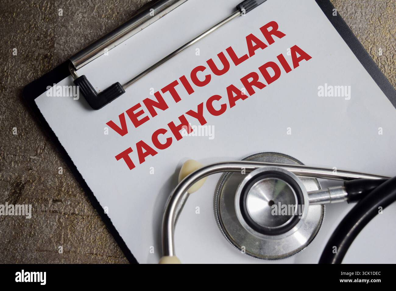 Concetto di tachicardia ventricolare scrivibile su appunti isolati su un tavolo in legno. Foto Stock