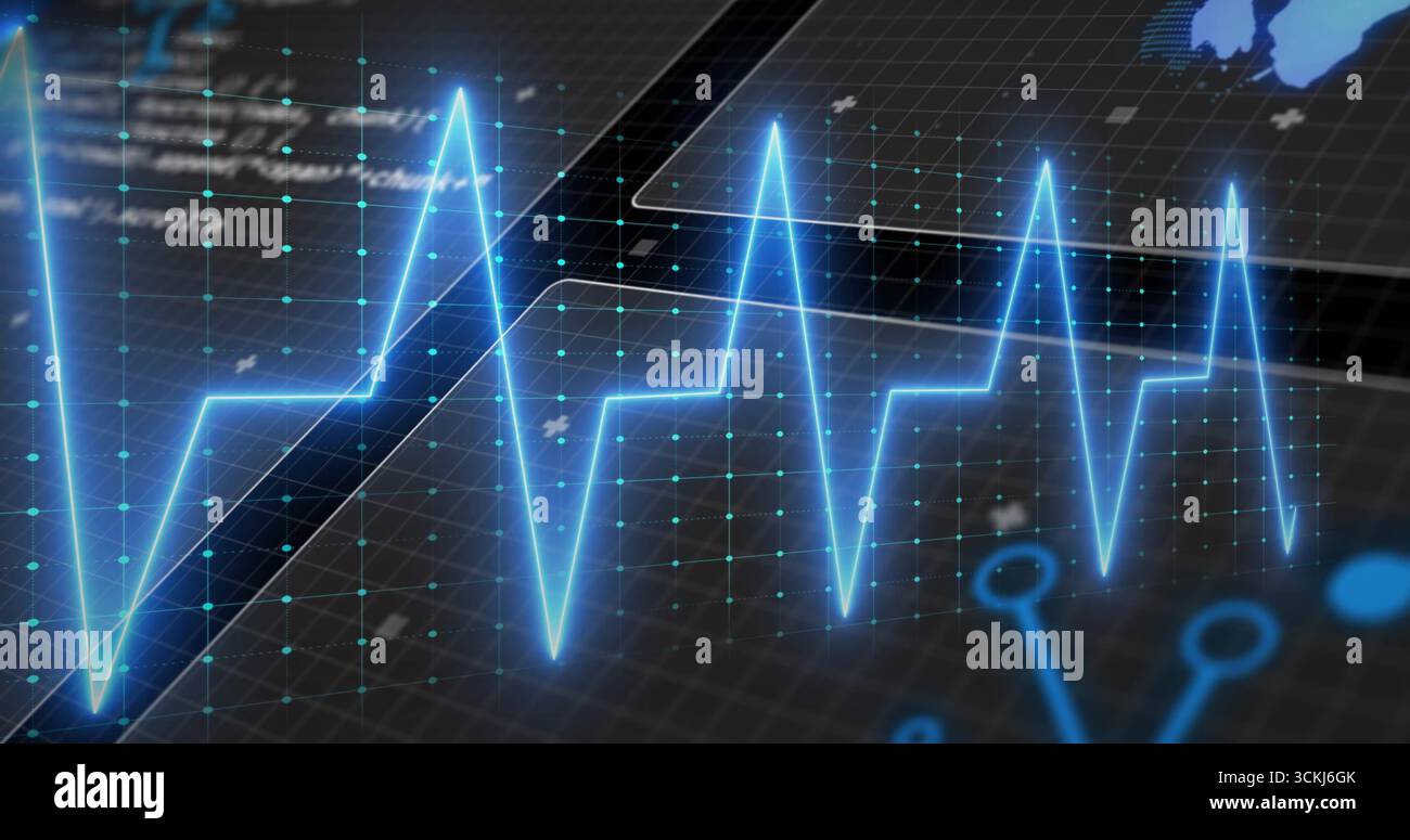 Visualizzazione della linea ECG blu neon che attraversa le griglie con nodi di dati, mappe e schemi di circuiti Foto Stock