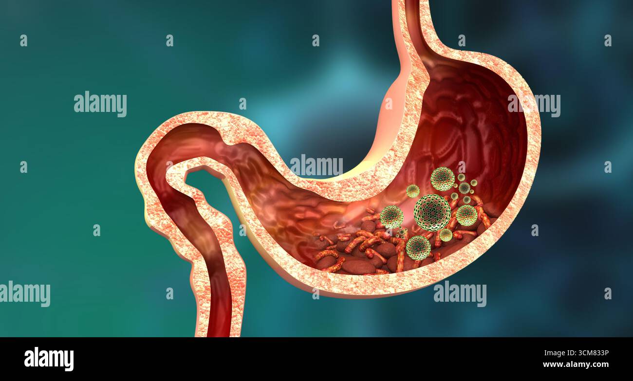 Sezione trasversale dello stomaco umano con virus e batteri. illustrazione 3d. Foto Stock