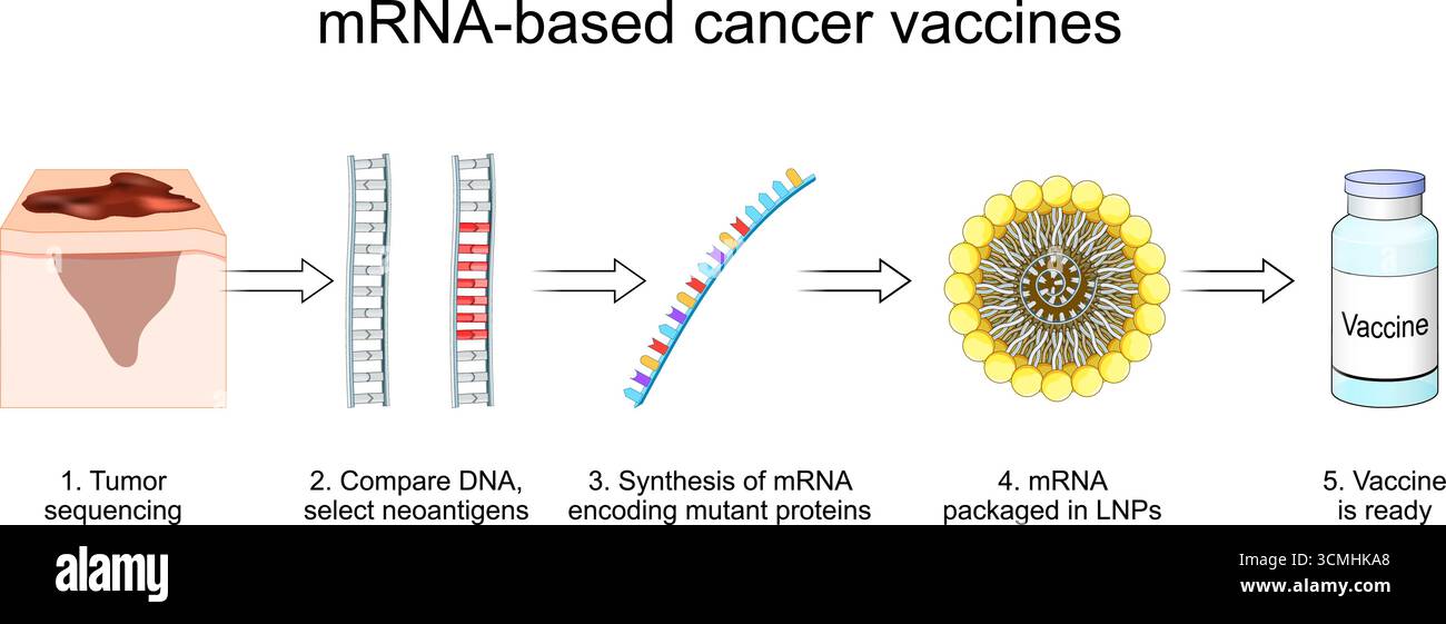 Vaccino antitumorale a base di mRNA. Trattamento immunoterapico del melanoma. cancro della pelle. Antigene tumorale. Oncologia personalizzata. Illustrazione vettoriale dettagliata per me Illustrazione Vettoriale