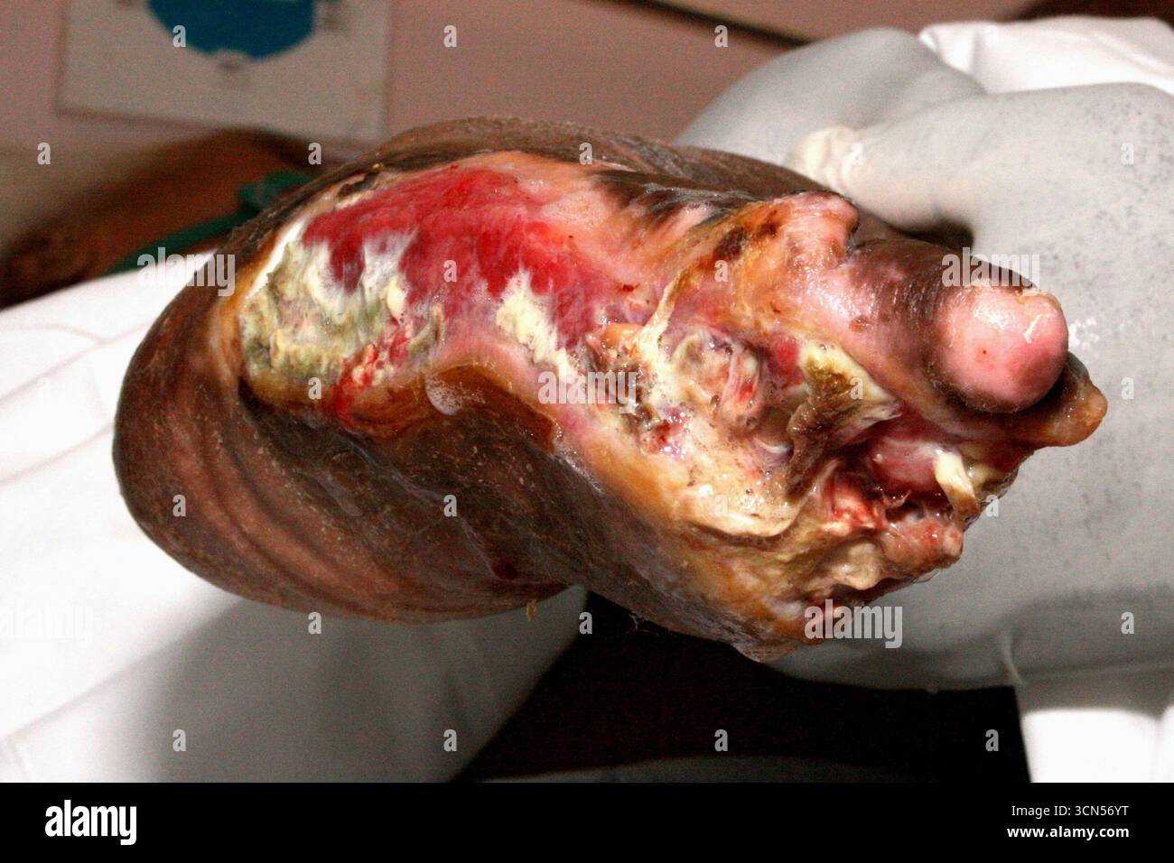 Piede di gangrena Foto Stock