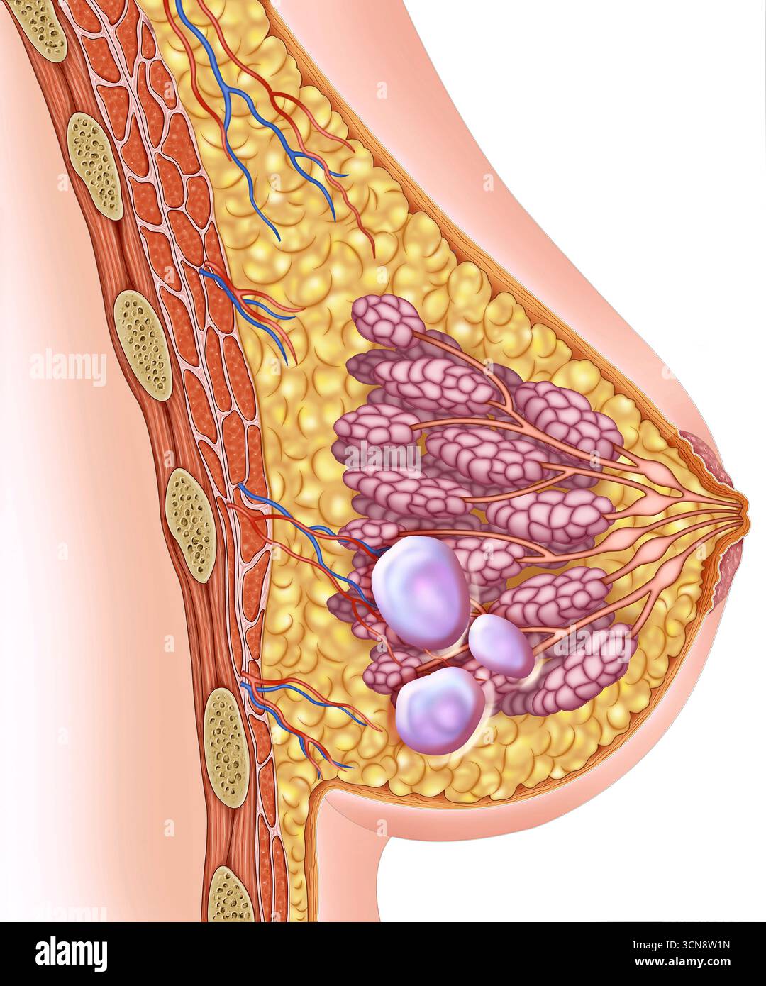 Immagine di una mammella femminile che mostra una cisti mammaria. Si tratta di una massa riempita di liquido che si forma nel tessuto mammario. Di solito sono benigne e possono cambiare di dimensione durante il ciclo mestruale. Le cisti mammarie spesso non richiedono un trattamento. Foto Stock
