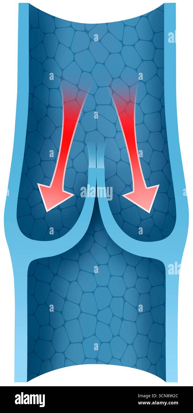 Immagine di una valvola venosa. Vediamo una valvola venosa sana. Si apre e si chiude per garantire che il sangue fluisca solo verso il cuore e impedisce il riflusso o la stagnazione nelle vene, soprattutto nelle estremità inferiori. Foto Stock