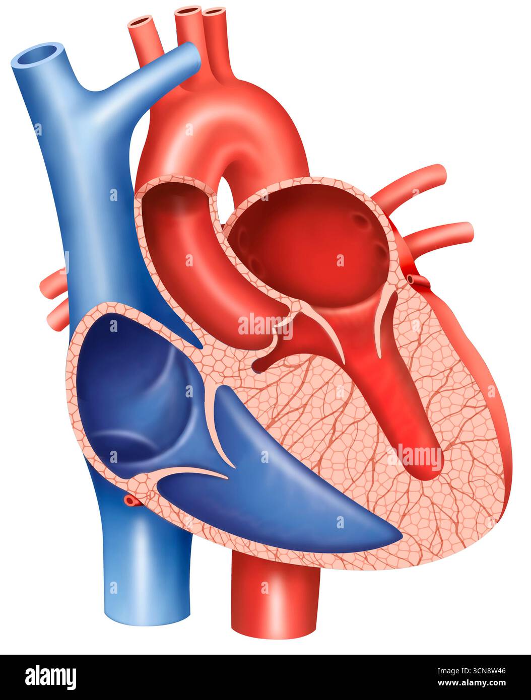 Illustrazione del cuore, in cui è possibile osservare la cardiomiopatia ipertrofica. Questa è una malattia cardiaca in cui il muscolo del ventricolo sinistro si addensa, rendendo difficile pompare il sangue. Questo può portare a sintomi come mancanza di respiro e affaticamento. Foto Stock