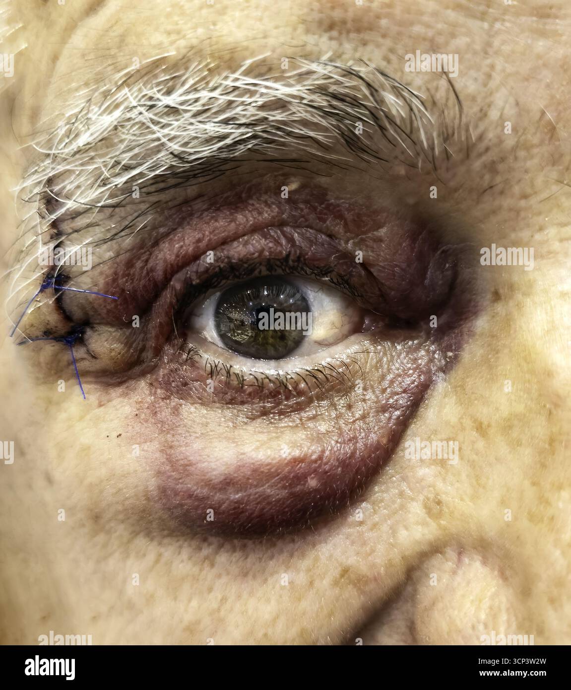 Salta e taglia all'occhio, punti Foto Stock